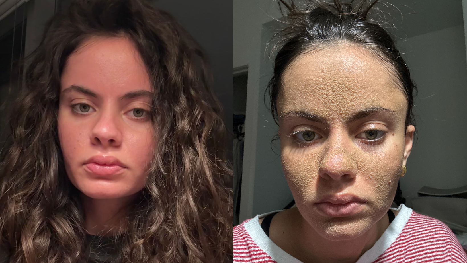 Cilt bakımı, Mağara Adamı Metodu, Tia Zakher, TikTok, viral, cilt sorunları, dermatoloji, cilt temizliği, nemlendirici, retansiyon hiperkeratozu, cilt bariyeri, cilt sağlığı, Kelsie Carolos, cilt dokusu, Montreal, ABD GÜNLÜK