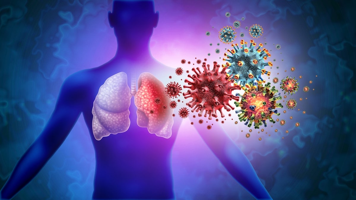 Aspergillus, Aspergilloz, mantar enfeksiyonu, küresel ısınma, iklim değişikliği, akciğer enfeksiyonu, immün yetmezlik, immünosupresyon, antifungal direnci, sağlık, enfeksiyon hastalıkları, pnömoni, mantar, fungal, yaşlılar, astım, toprak, ilaç, tanı, tedavi, araştırmalar, Centivax, Fox News Digital, Research Square, iklim senaryoları
