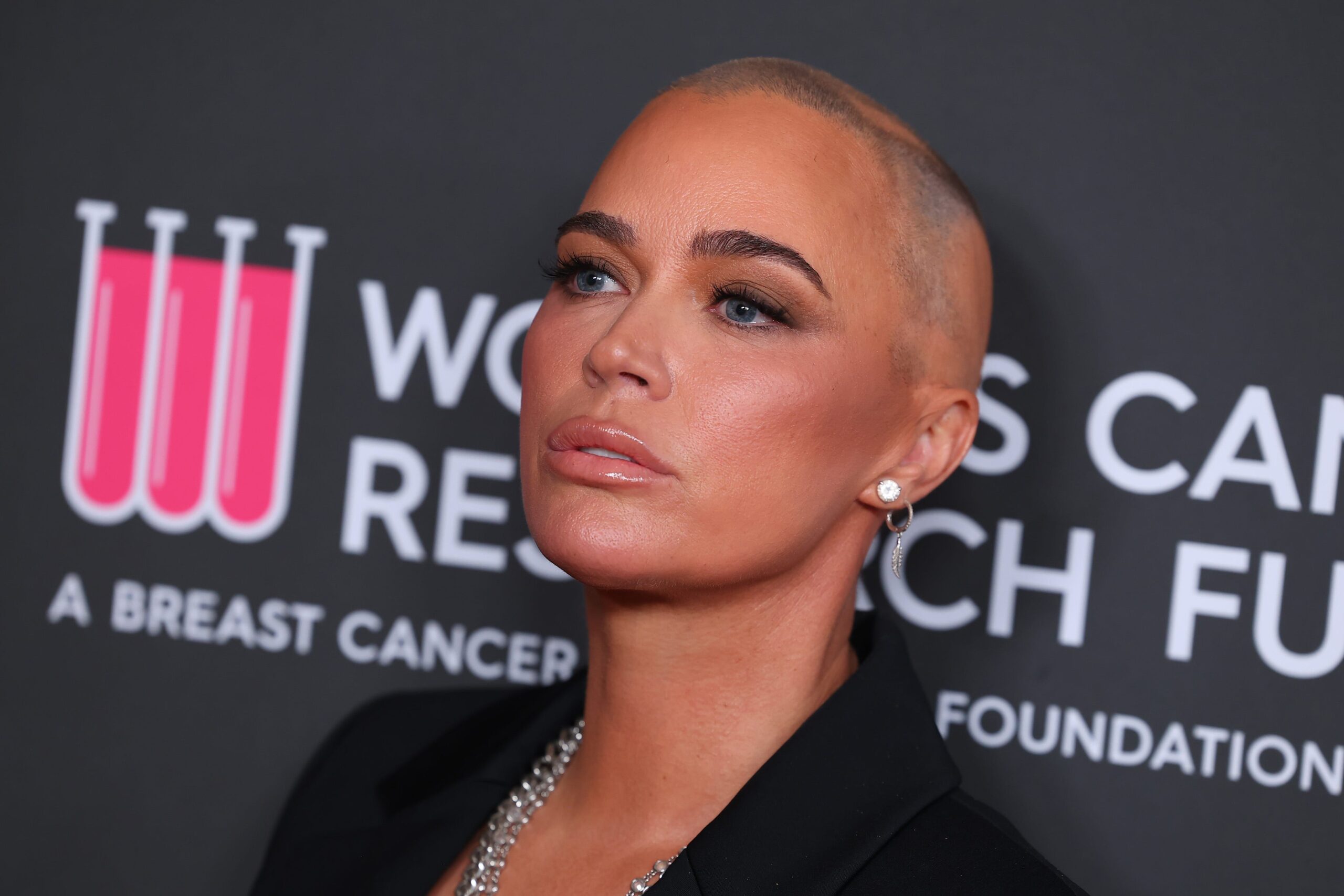 Teddi Mellencamp, melanoma, cilt kanseri, Real Housewives of Beverly Hills, sağlık, kanser tedavisi, kemoterapi, radyasyon, bağışıklık tedavisi, teşhis, semptomlar, beyin tümörleri, akciğer tümörleri, erken teşhis, yaşam tarzı, sağlık ipuçları, John Mellencamp, Kyle Richards, podcast, wellness koçu, tıbbi tavsiye, sağlık bilinci, erken menopoz, belirtiler, taramalar, self-diagnosis, tedavi, tümör, survivor, doktor, sağlık kontrolleri, metastaz, metastatik melanoma, stage 4 melanoma
