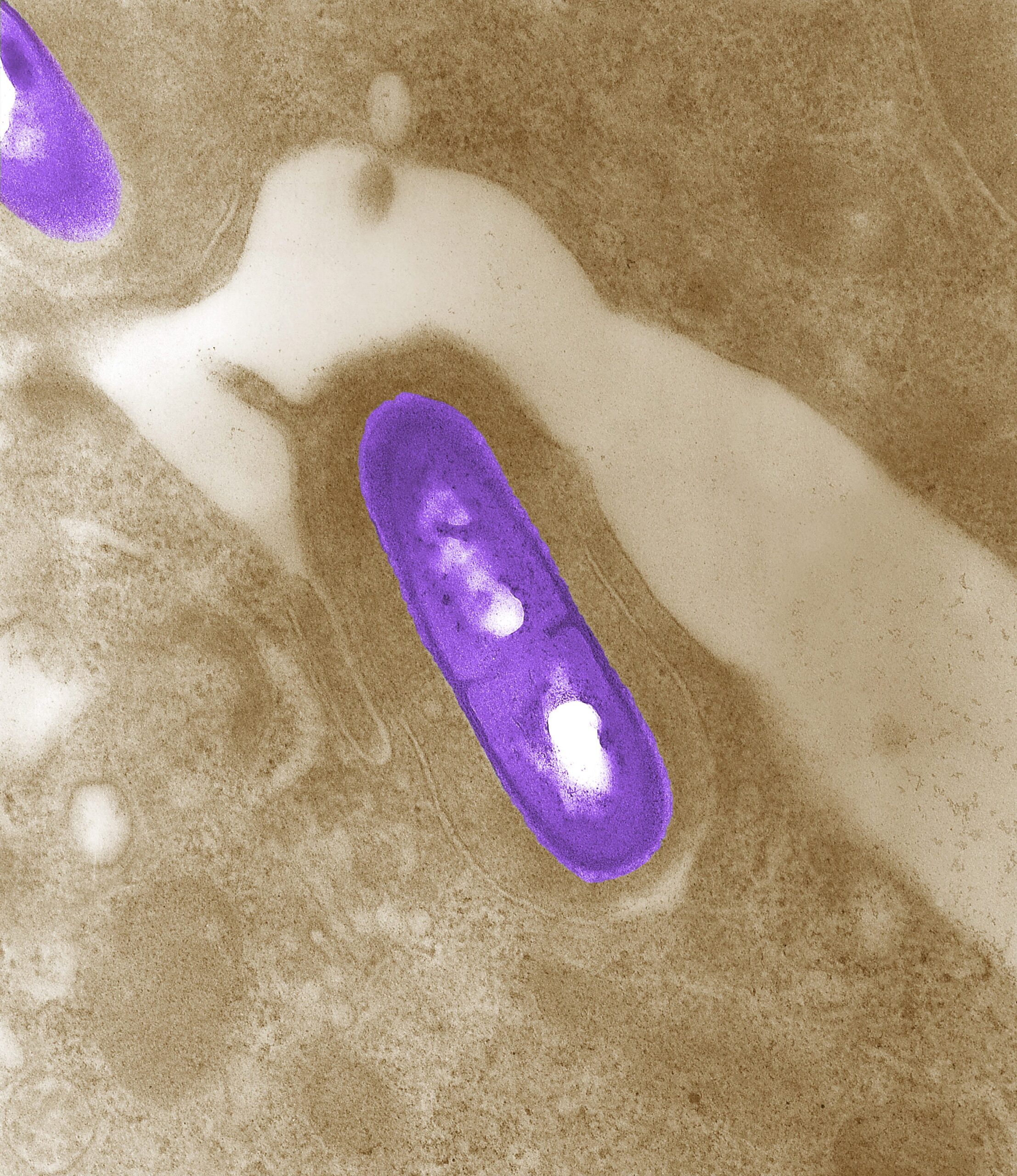 listeria salgını, gıda geri çağırma, Fresh & Ready Foods, hazır gıda, gıda güvenliği, FDA, CDC, listeriosis, gıda zehirlenmesi, Arizona, California, Nevada, Washington, sağlık uyarısı, tüketici sağlığı, gıda kaynaklı hastalık, enfeksiyon, bakteri, semptomlar, hamilelik, yaşlılar, bağışıklık sistemi, hastane, otel, market, havaalanı, uçak

